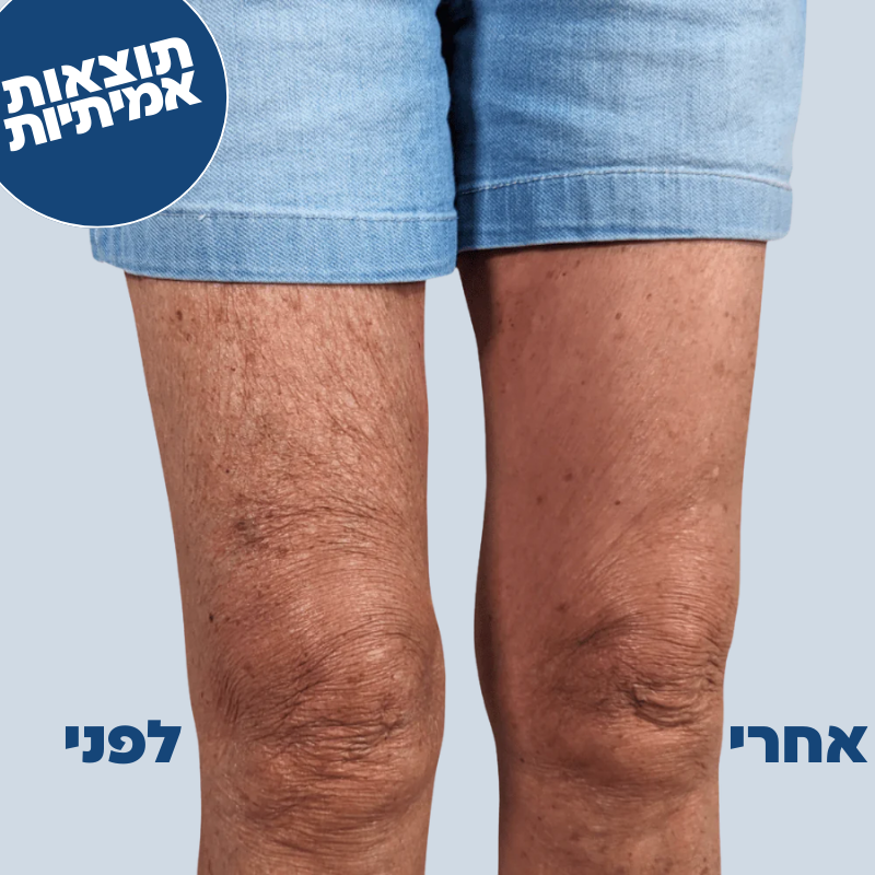 מדבקות לרגליים ולישבן